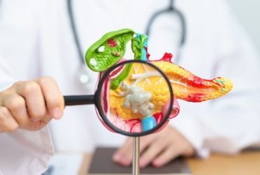 Doctor with human Pancreatitis anatomy model with Pancreas, Gallbladder, Bile Duct, Duodenum, Small intestine and magnifying glass. Pancreatic cancer, acute pancreatitis and Digestive system