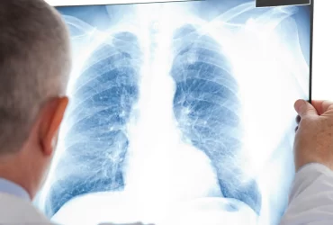 radiografia-torax-3249266